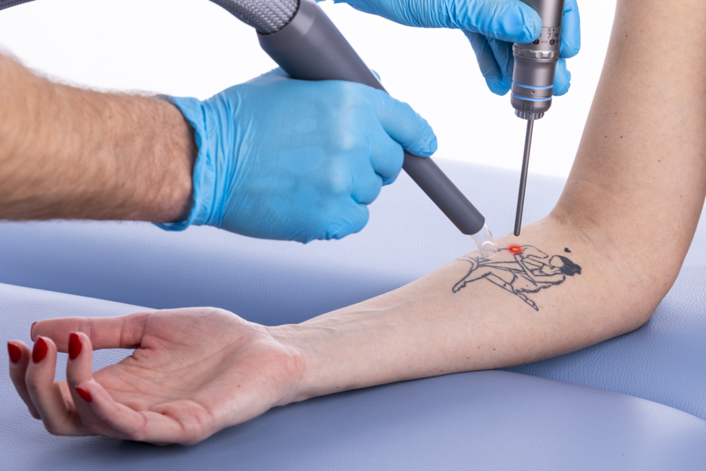 Cryotherapie-3