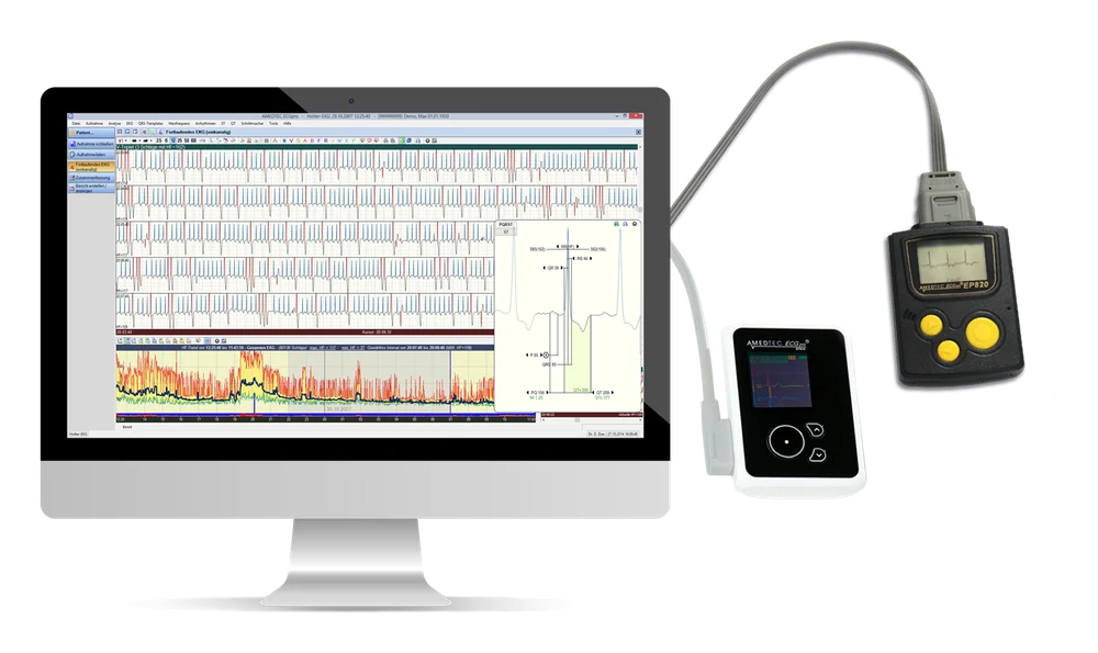 AMEDTEC Langzeit-EKG mit Holter-Rekordern EP 830 und EP 820 und Analysesoftware