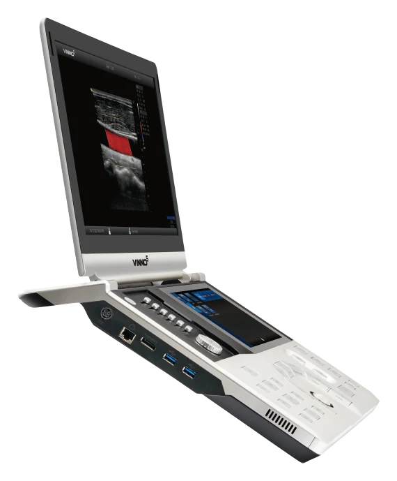 VINNO 5, tragbares Ultraschallsystem mit Touch-Bedienfeld